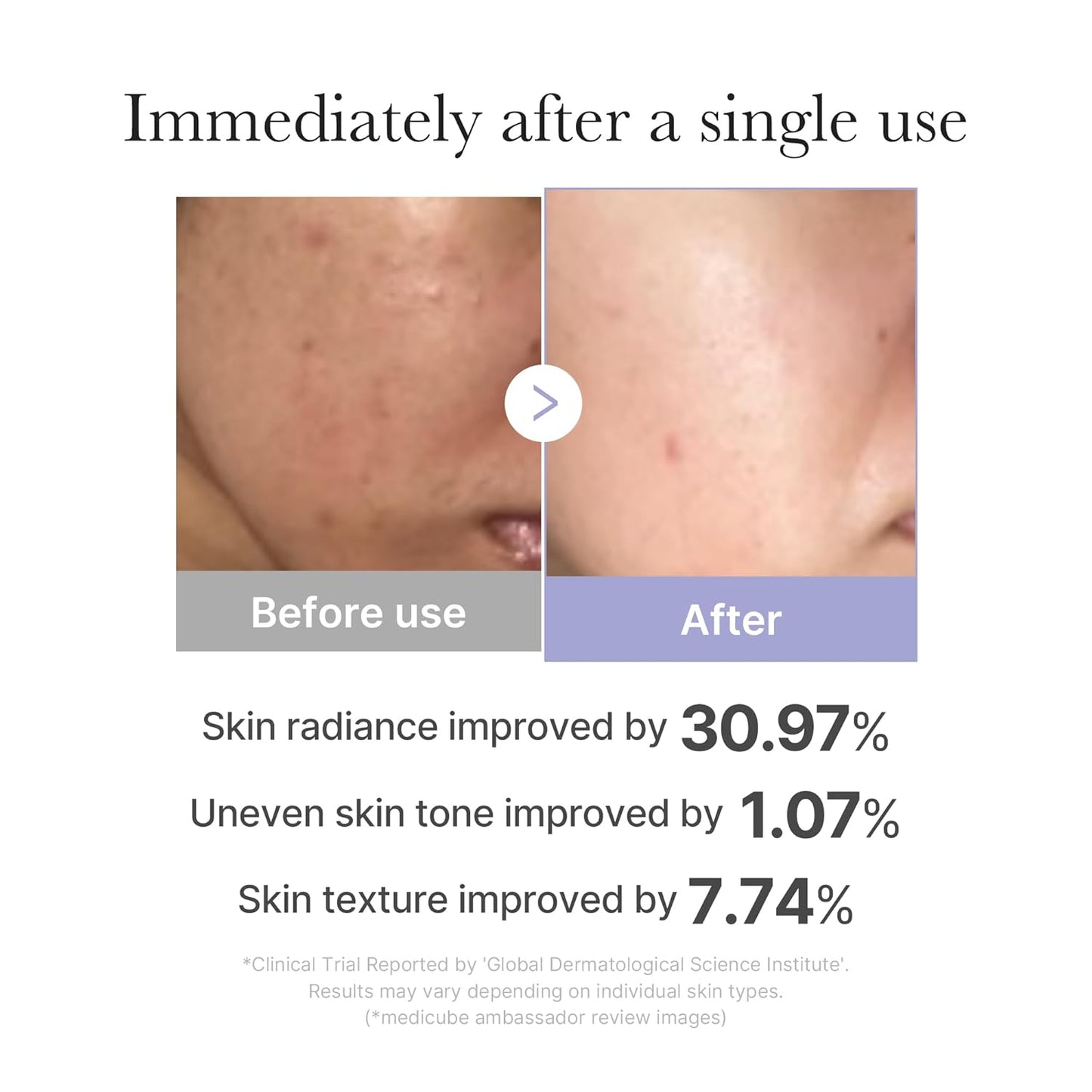[Medicube] AGE-R Booster Pro Mini color Blanco
