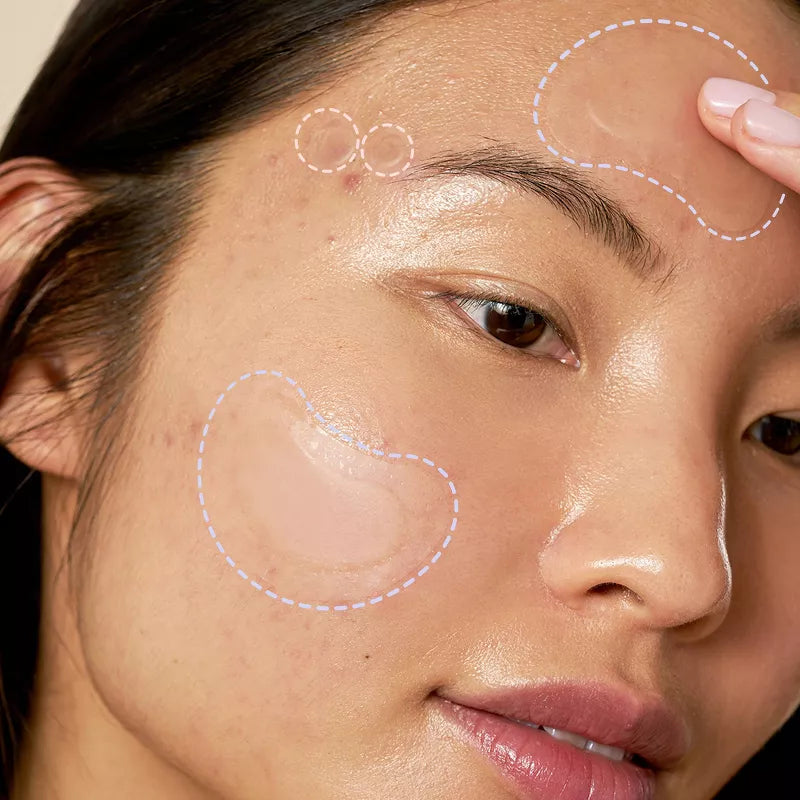 [Rael Beauty] Parches para Acné + Parches para control de manchas dúo.