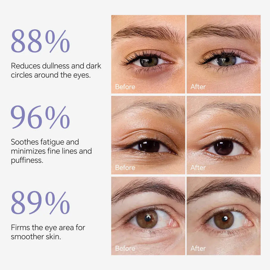 [CartaLyar] Corrector para Ojeras con Bakuchiol + Péptidos