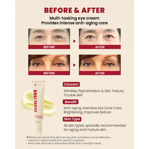 [KSECRET] Seoul 1988 Eye Cream Retinal Liposome 4% + Fermented Bean – 30 ml